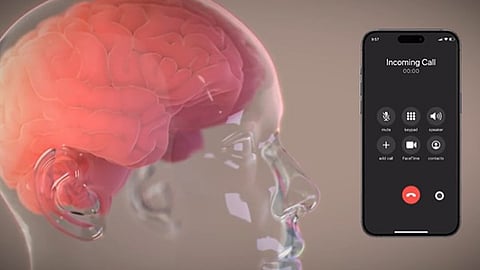 ഇലോണ് മസ്കിന്റെ ന്യൂറാലിങ്ക് കമ്പനിയുടെ ബ്രെയിന് ചിപ്പ് പ്രവര്ത്തനം