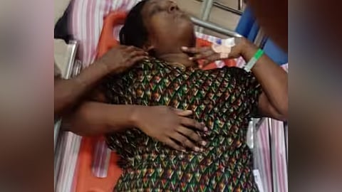 വീട്ടമ്മയ്ക്ക് നേരെ കാട്ടുപന്നി ആക്രണം