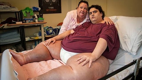 UK’s ‘Heaviest Man’ Jason Holton