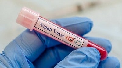 NIPAH CASE