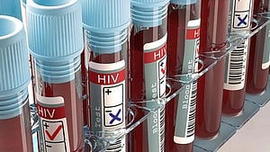 hiv-crisis-in-tripura-47-students-dead