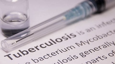 Affordable TB testing technology developed