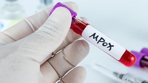 Mpox detected in India