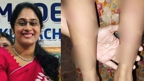 brutally beating a five-year old boy teacher arrested