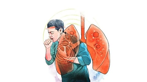 tuberculosis