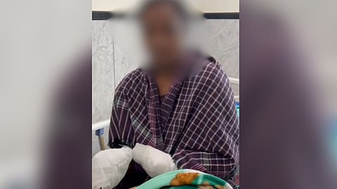 Hair dryer explosion