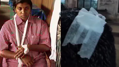 Police beat people returning from a wedding; lathi-charge, woman injured in shoulder,complaint