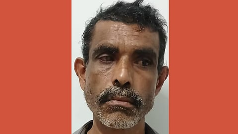 ACID ATTACK CASE