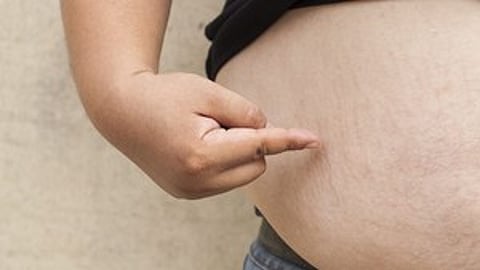 how to reduce obesity