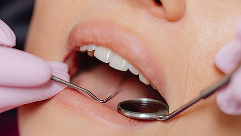 A Patient Undergoing a Dental Procedure