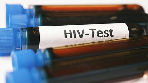 blood collected for HIV TEST