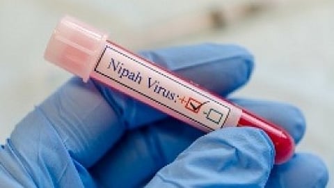 543 people currently on Nipah virus contact list