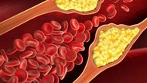 representative image of heart