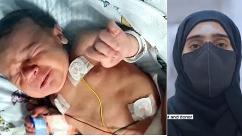 UAE  liver transplant