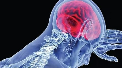 Amoebic Meningoencephalitis