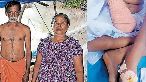 Child lost her arm due to alleged medical negligence