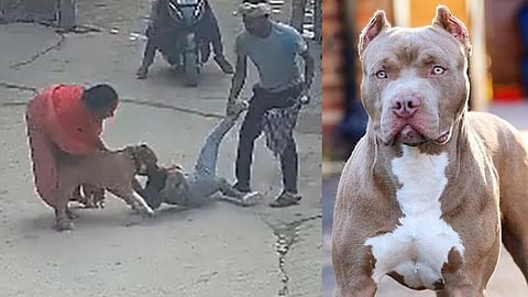 pitbull attack