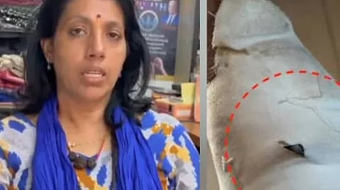 Surgical blade found in pilgrim's leg wound; treatment error at Pampa Hospital