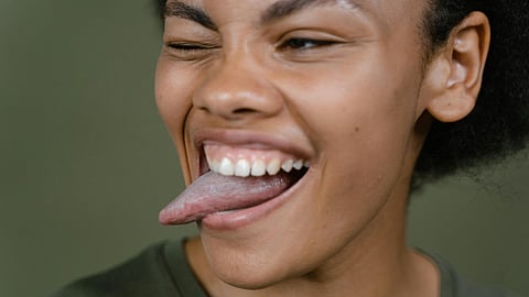 Tongue health issues