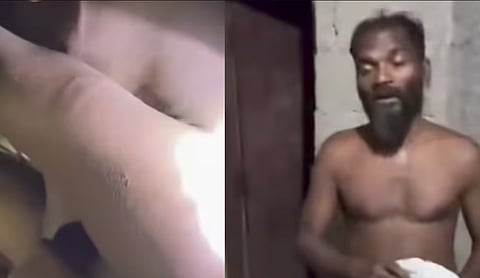 Father arrested for brutally beating 13-year-old son with axe