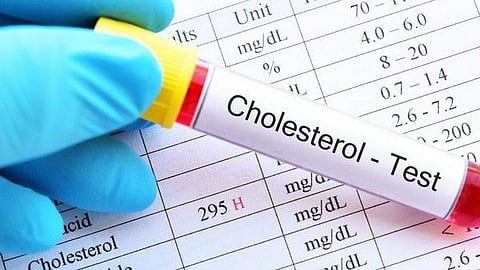 Cholestrol test