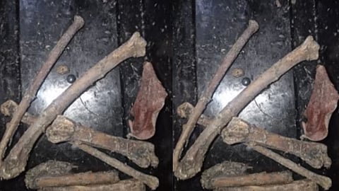 Human bone fragments found under suspicious circumstances in Arimpur