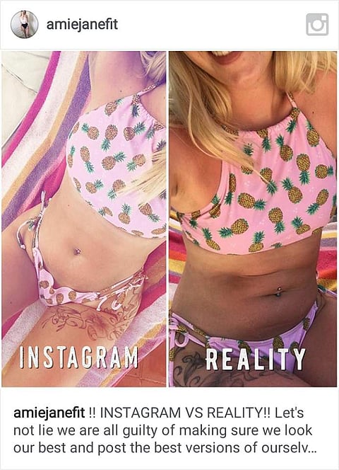 'ഇംപെര്ഫെക്ഷന്സ്' തുറന്നുകാട്ടി ആമി ജെയിന് ഇന്സ്റ്റഗ്രാമില് തരംഗമാകുന്നു