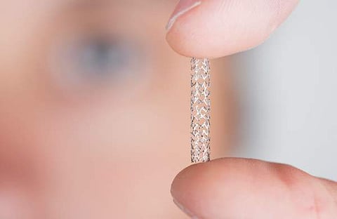 സ്റ്റെന്റ്