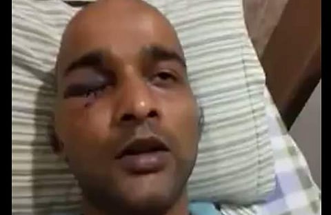 ബീഫ് കഴിക്കുന്ന നിന്നെ കൊല്ലും എന്ന് പറഞ്ഞ് ആക്രമിച്ചു;കേസ് അട്ടിമറിക്കാന് ശ്രമിക്കുന്നു, ഐഐടിയിലെ അക്രമം തുറന്നുപറഞ്ഞ് സൂരജ്