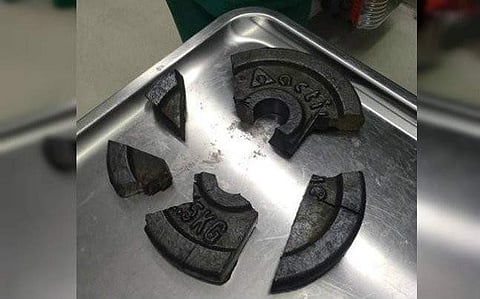 ജിമ്മിലെ വെയിറ്റ് പ്ലേറ്റില് യുവാവിന്റെ ജനനേന്ദ്രിയം കുടുങ്ങി; രക്ഷിക്കാന് അഗ്നിശമനസേന വരേണ്ടി വന്നു