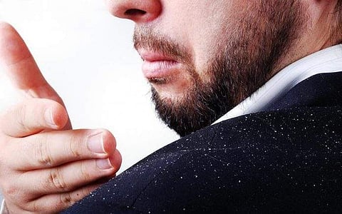 തോല്പ്പിക്കാം താരനെ