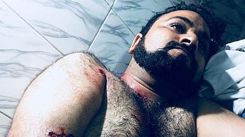 കഫീല് ഖാന്റെ സഹോദരന് വെടിയേറ്റു; അവര് തങ്ങളെ എപ്പോഴും കൊല്ലാന് ശ്രമിക്കുന്നുവെന്ന് കഫീല്ഖാന്