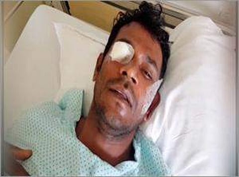 കോടതി ജാമ്യം നല്കരുതെന്ന് പൊലീസ്; താടിയെല്ല് തകര്ന്ന ഉസ്മാന് റിമാന്ഡില്