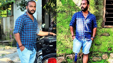 ഒറ്റക്കാലുള്ള നിങ്ങളെ കല്യാണം കഴിച്ചാല് നമ്മളെങ്ങനെ ജീവിക്കും?സ്നേഹിച്ച പെണ്ണ് വഞ്ചിച്ചു; നല്ല നട്ടെല്ലുള്ള ആണ്പിള്ളേര്ക്ക് ഒരു കാല് തന്നെ ധാരാളം...; ചെറുപ്പക്കാരന്റെ അതിജീവനകഥ