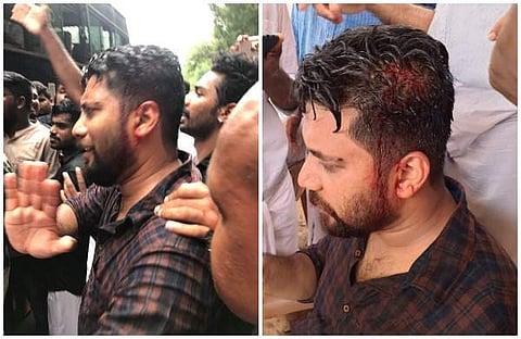 കെഎസ്യു മാര്ച്ചില് സംഘര്ഷം; ഷാഫി പറമ്പില് എംഎല്എ ഉള്പ്പെടെയുള്ളവര്ക്ക് പരിക്ക്