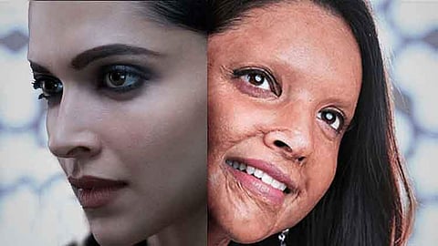 മേക്കപ്പണിഞ്ഞ് പുറത്തിറങ്ങിയപ്പോൾ ആരും എന്നെ തിരിച്ചറിഞ്ഞില്ല, ആദ്യമായി പ്രോസ്തെറ്റിക് ചിത്രത്തിൽ അഭിനയിച്ചതിനെക്കുറിച്ച് ദീപിക