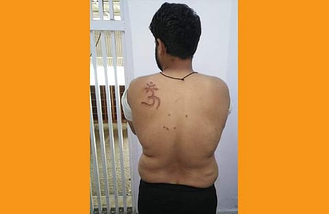 തിഹാര് ജയിലില് മുസ്ലിം തടവുകാരന്റെ ശരീരത്തില് 'ഓം'പച്ചകുത്തി സൂപ്രണ്ട്; പരാതി, അന്വേഷണം