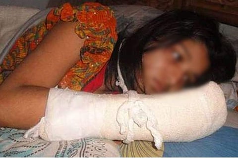 താനറിയാതെ ഭാര്യ ഡിഗ്രിക്ക് ചേര്ന്നു; കൈവിരലുകള് അറുത്തുമാറ്റി പ്രവാസി ഭര്ത്താവിന്റെ ക്രൂരത