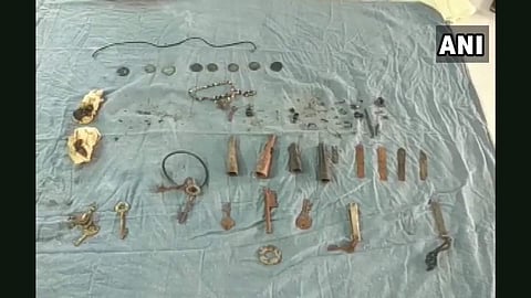 'ഡോക്ടറെ എന്നെ രക്ഷിക്കണേ, വയറുവേദന സഹിക്കാന് വയ്യ'; രോഗിയുടെ വയറ്റില് നിന്നും താക്കോല്, നാണയങ്ങള്, ഉള്പ്പെടെ കണ്ടെടുത്തത് 80 സാധനങ്ങള്; അമ്പരപ്പ്