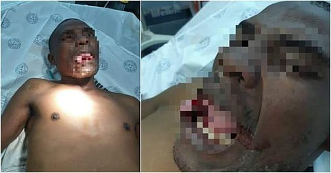 രോഗിയാണെന്ന വ്യാജേന ആശുപത്രിയിലെത്തി; ബലാത്സംഗം ചെയ്യാന് ശ്രമിച്ച 32 കാരന്റെ നാവ് വനിത ഡോക്ടര് കടിച്ചുമുറിച്ചു