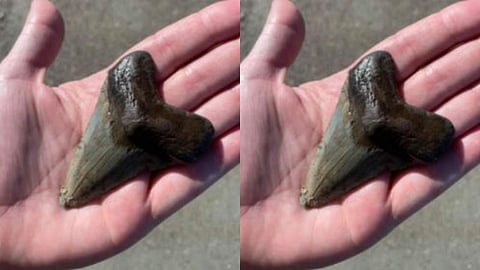 ഉള്ളംകൈയുടെ വലുപ്പമുള്ള പല്ല്; ഞെട്ടല്