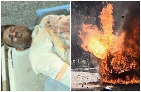 ആളിപ്പടര്ന്ന തീയില് നിന്ന് മുസ്ലിം കുടുംബത്തെ രക്ഷിച്ചു; പൊള്ളലേറ്റ് വീട്ടില് കഴിയേണ്ടിവന്നത് ഒരുരാത്രി മുഴുവന്, മനുഷ്യത്വത്തിന് കിട്ടിയ 'ശിക്ഷ'