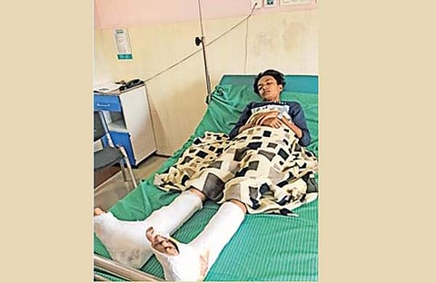 റോഡില് നിന്ന് ഇറങ്ങി നടന്നില്ല; വിദ്യാര്ത്ഥിയെ ഇടിച്ചിട്ട് കാലുകളിലൂടെ കാര് കയറ്റിയിറക്കി, ഗുരുതര പരിക്ക്