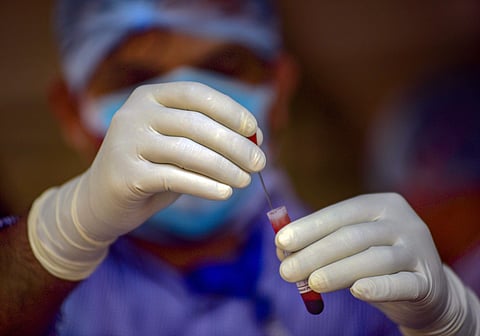 പ്ലാസ്മ ചികിത്സ: കേരളത്തിന് ക്ലിനിക്കല് ട്രയല് അനുമതിയില്ല; ശ്രീചിത്രയും തിരുവനന്തപുരം മെഡിക്കല് കോളജും തമിഴ്നാട് പട്ടികയില്