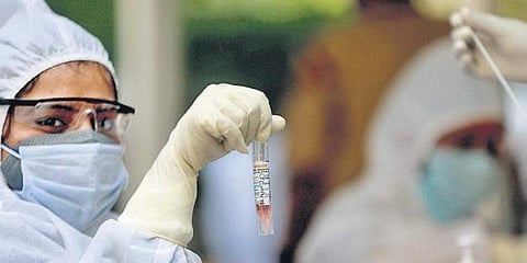 625 രൂപയ്ക്ക് കോവിഡ് പരിശോധന, അംഗീകാരമുള്ള ലാബുകളുടേയും സ്വകാര്യ ആശുപത്രികളുടേയും പട്ടിക ഇറക്കി