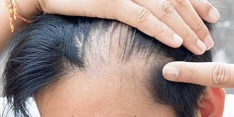 പ്രതീകാത്മക ചിത്രം