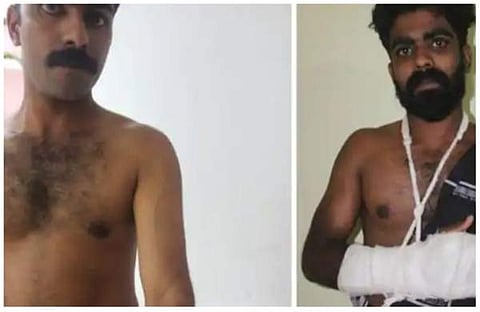 പൊലീസ് മര്ദനത്തില് പരിക്കേറ്റ സഹോദരങ്ങള്