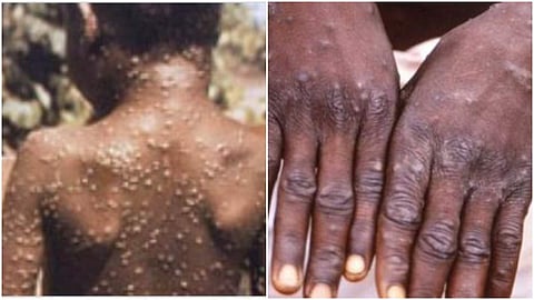 ഫയല് ചിത്രം