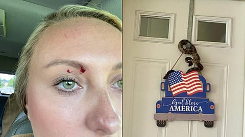 വാതിലില് തൂങ്ങിക്കിടന്ന പാമ്പ് യുവതിയുടെ പുരികത്തില് കടിച്ചപ്പോള്, ഫെയ്സ്ബുക്ക്