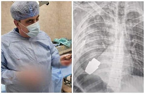 പുറത്തെടുത്ത ഗ്രനേഡുമായി ഡോക്ടര്, സൈനികന്റെ എക്സ്റെ